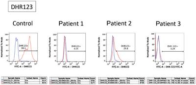 Case Report: The leopard sign as a potential characteristic of chronic granulomatous disease-associated colitis, unrelated to colitis severity